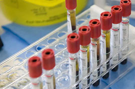 Benevento, furto all’interno di laboratorio di analisi