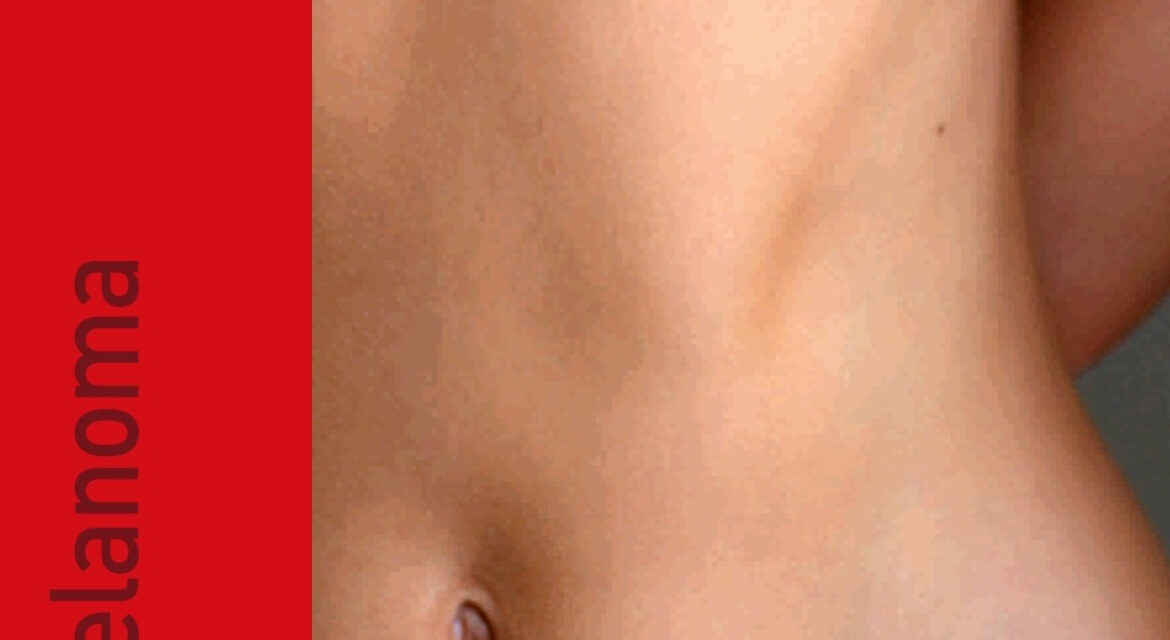 Arrivato, alla sede Lilt di Benevento un videodermatoscopio di ultima generazione